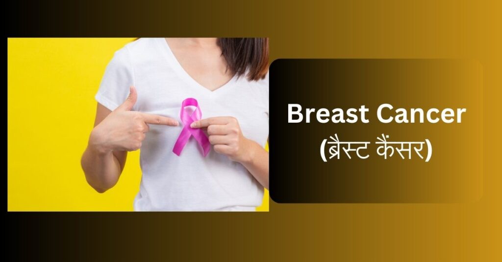 Breast Cancer (ब्रैस्ट कैंसर): कारण, लक्षण, प्रकार और इलाज?