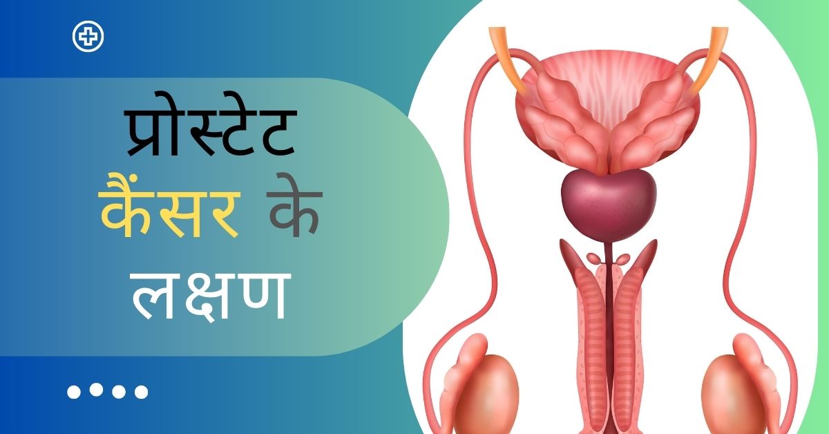 Prostate Cancer in Hindi